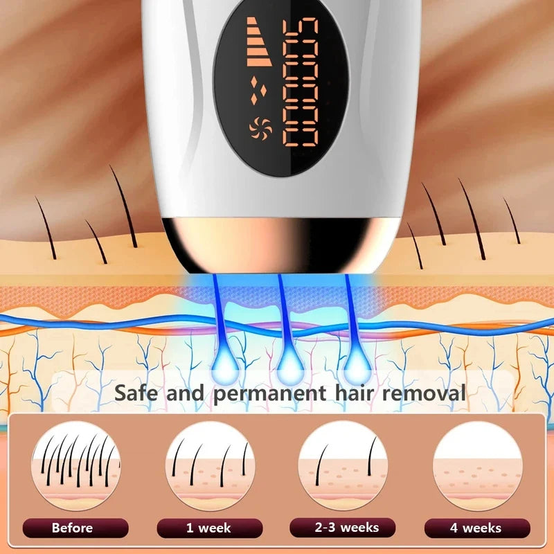 Épilateur IPL - Utilisation sur les jambes