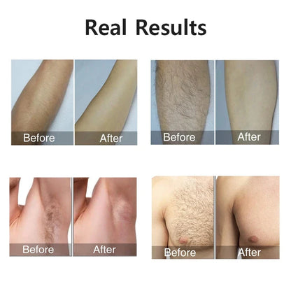 990000 Flashes IPL Laser Epilator, Painless Permanent Hair Removal Device, Facial Body Bikini Shaver for Women